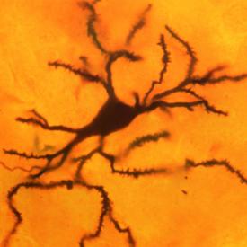 striatal neuron golgi stack