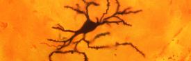 Striatal neuron golgi stack